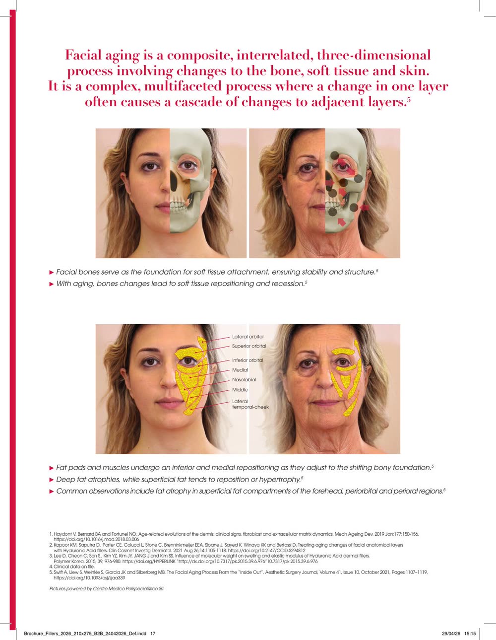 Envejecimiento facial tridimensional: hueso, tejido blando y piel