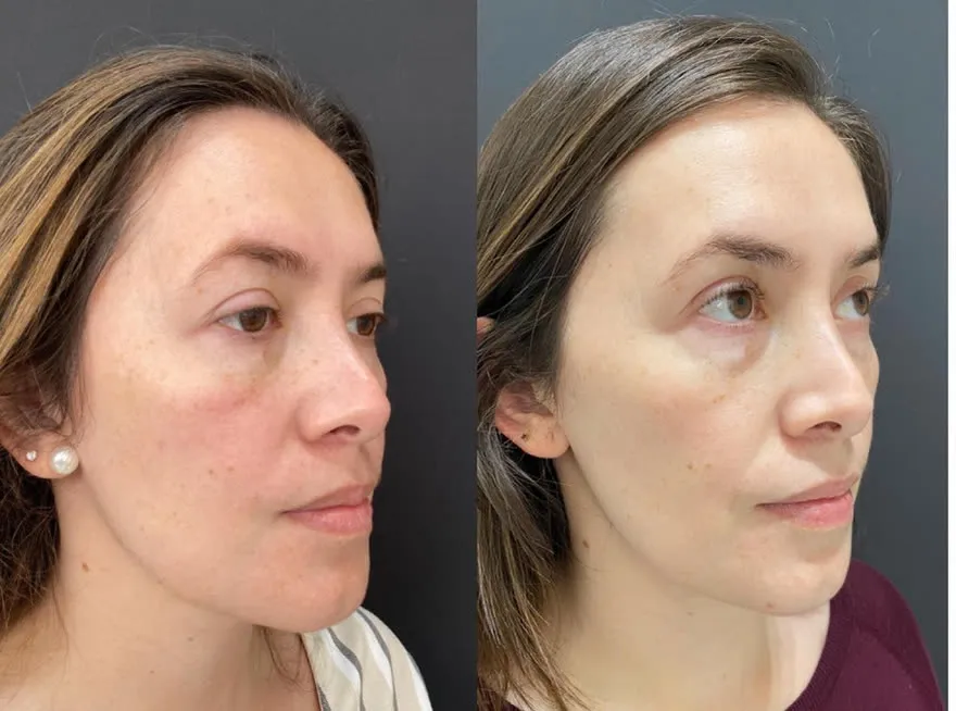 Caso de fotodano del Dr. Ricardo Sandoval, antes y despues