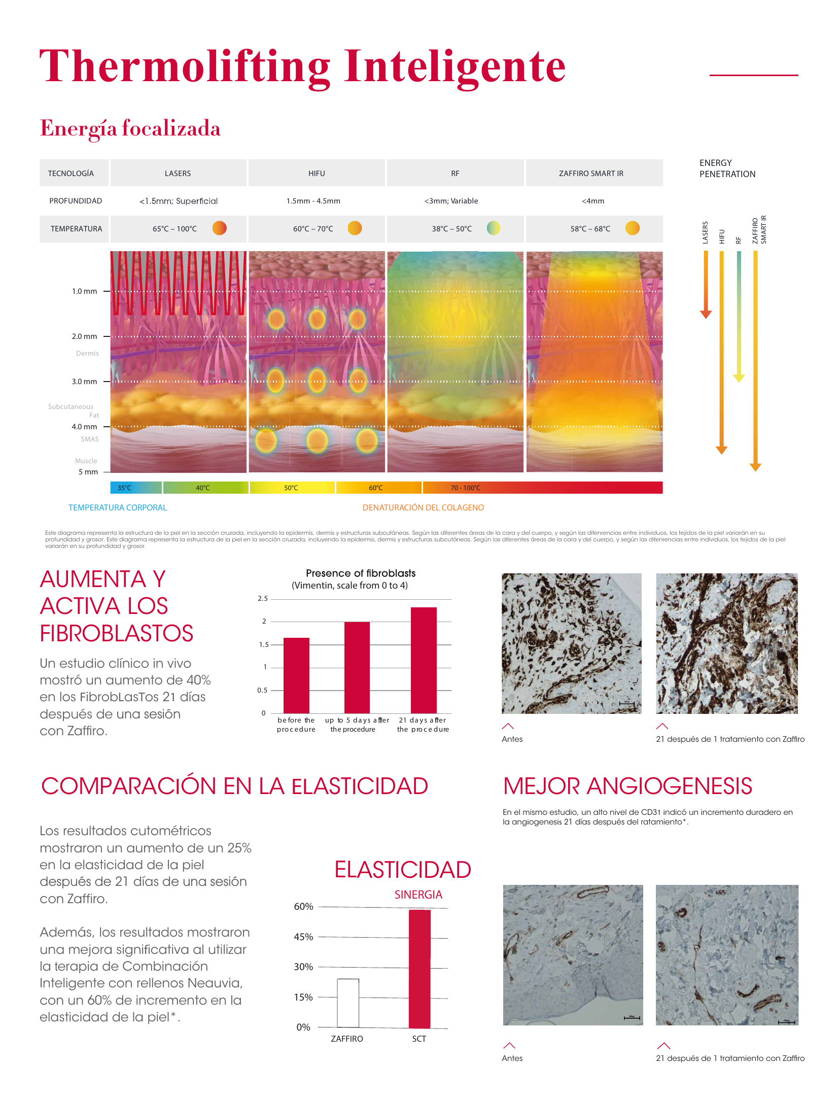 Diagrama comparativo de penetración energética: Láser, HIFU, radiofrecuencia y Zaffiro Smart IR
